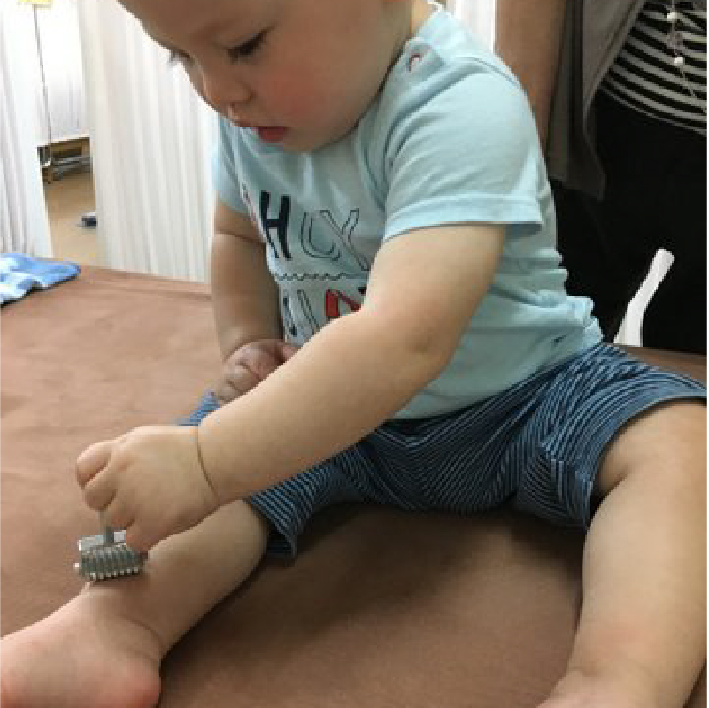 赤ちゃんの治療画像