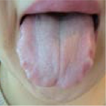 舌診画像